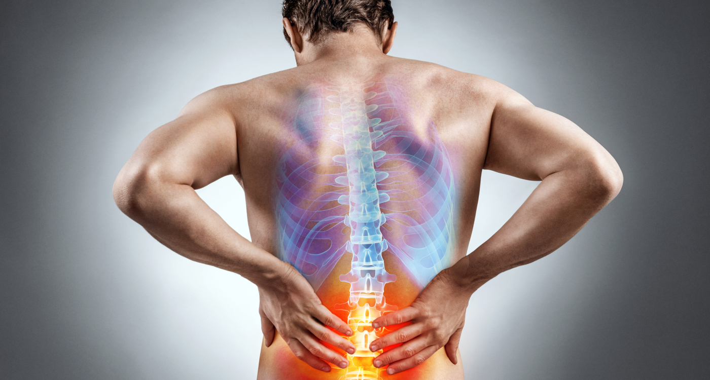 Sciatica: What It Is, Causes, Symptoms, Treatment & Pain Relief